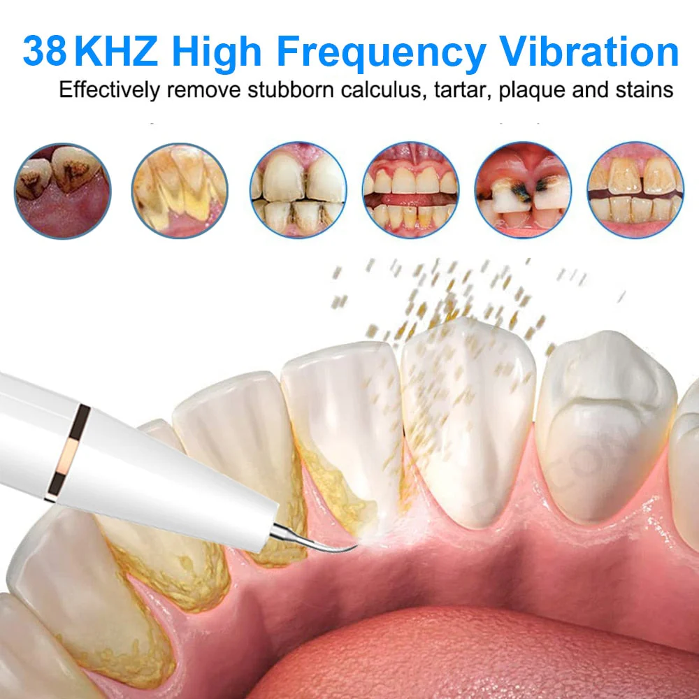 Gentle Touch Rechargeable Ultrasonic Tooth Cleaner Set - Image 2