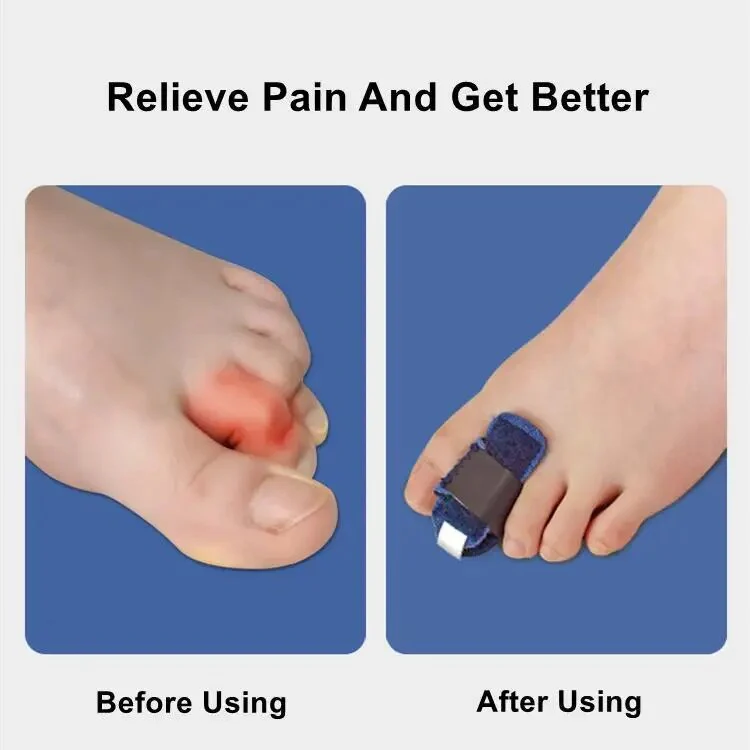 Gentle Touch Toe Corrector Stabilizer - Image 11