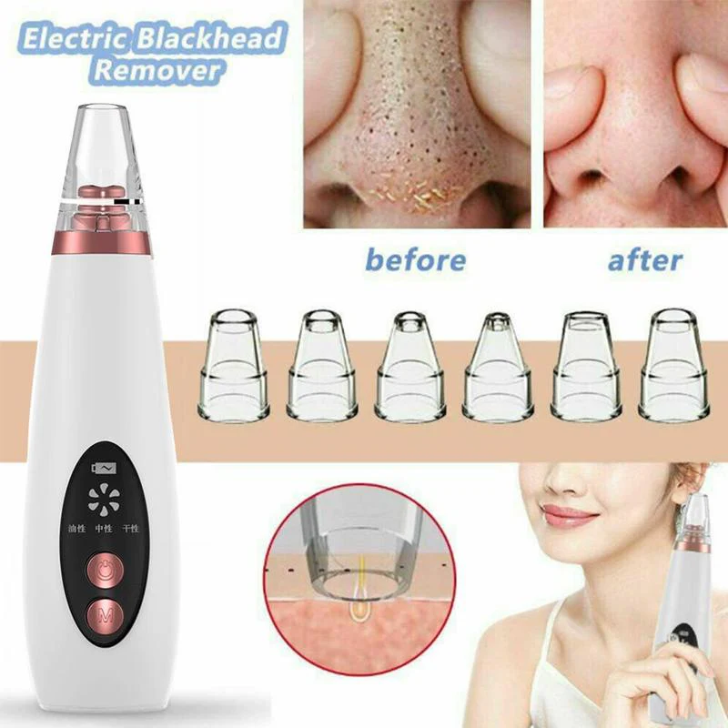 Pure Skin Rechargeable Blackhead Remover Machine - Image 2
