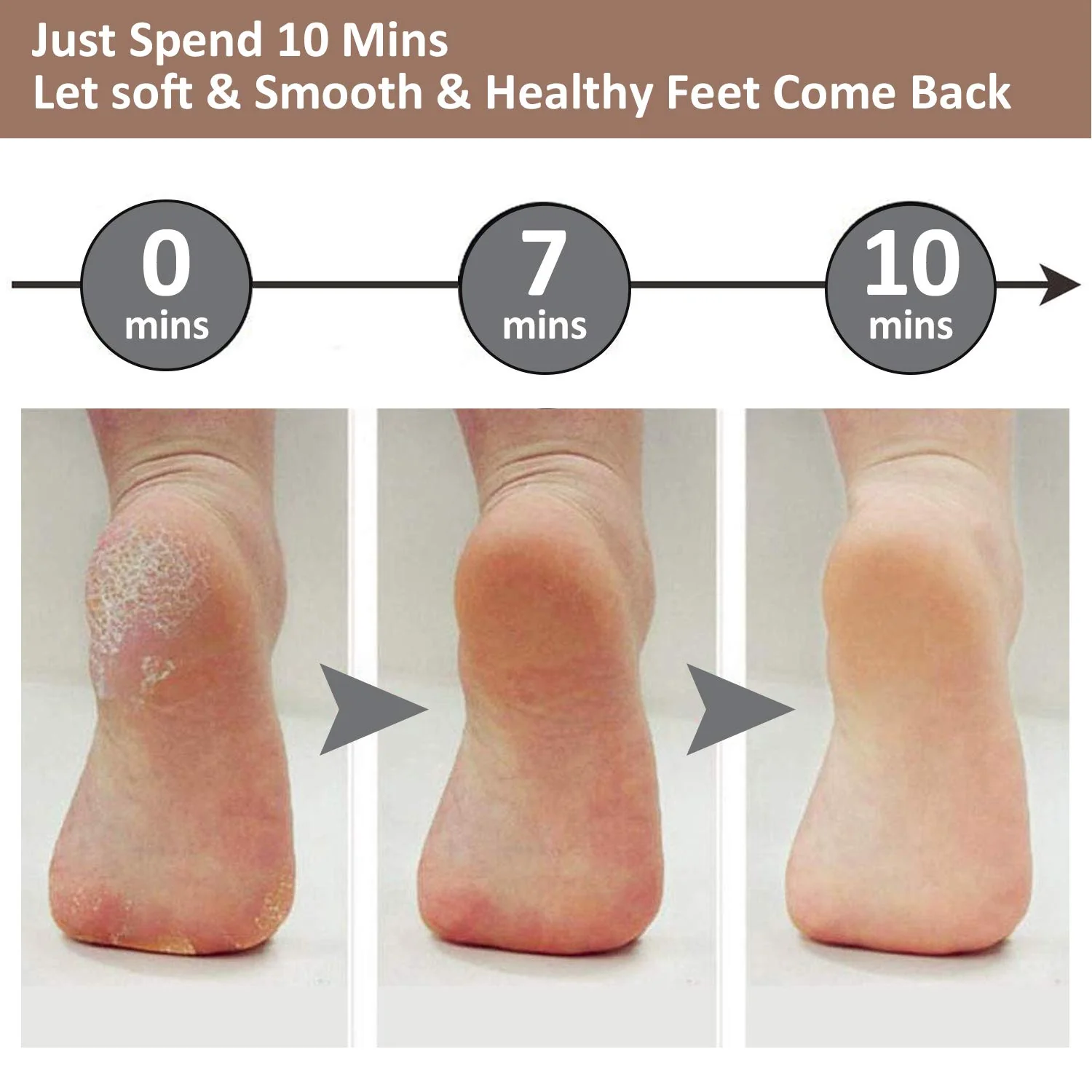 Rechargeable Foot Pedicure Machine - Image 3