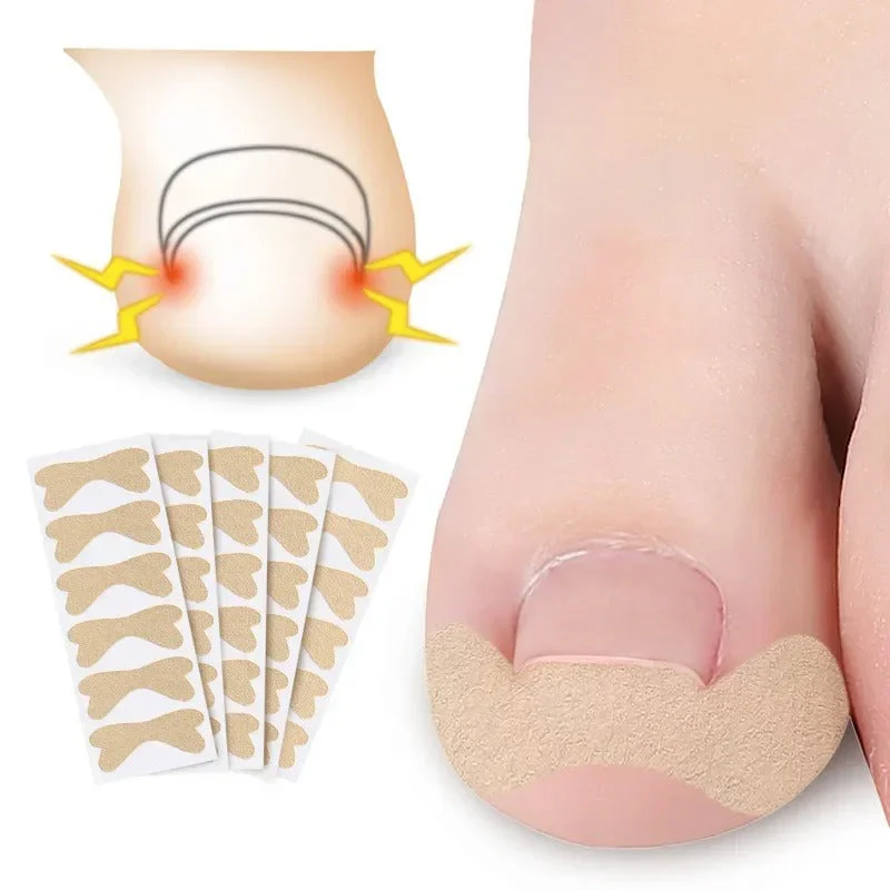 Toe Align Ingrown Nail Corrector Stickers - Image 12