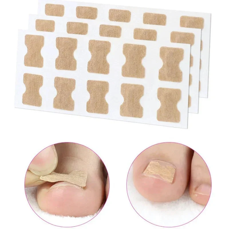 Toe Align Ingrown Nail Corrector Stickers - Image 14