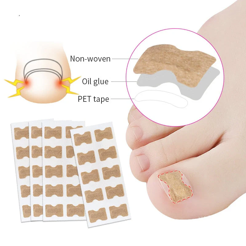 Toe Align Ingrown Nail Corrector Stickers - Image 3