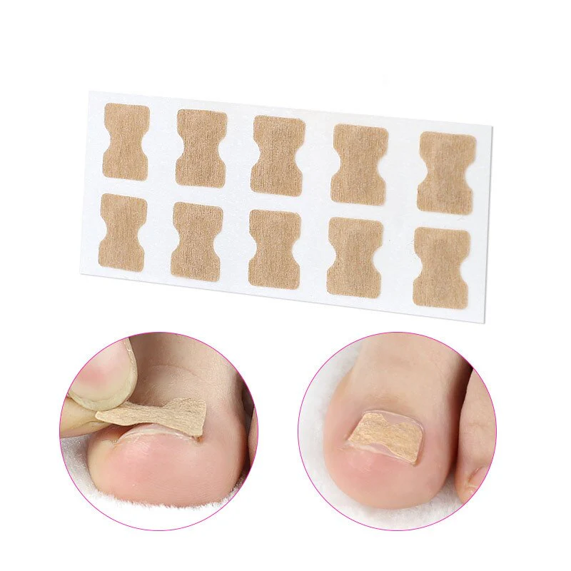 Toe Align Ingrown Nail Corrector Stickers - Image 7