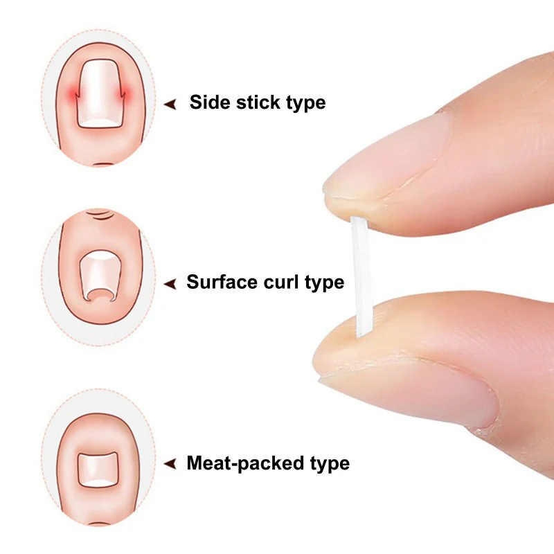 Toe Nail Support Pad - Image 4
