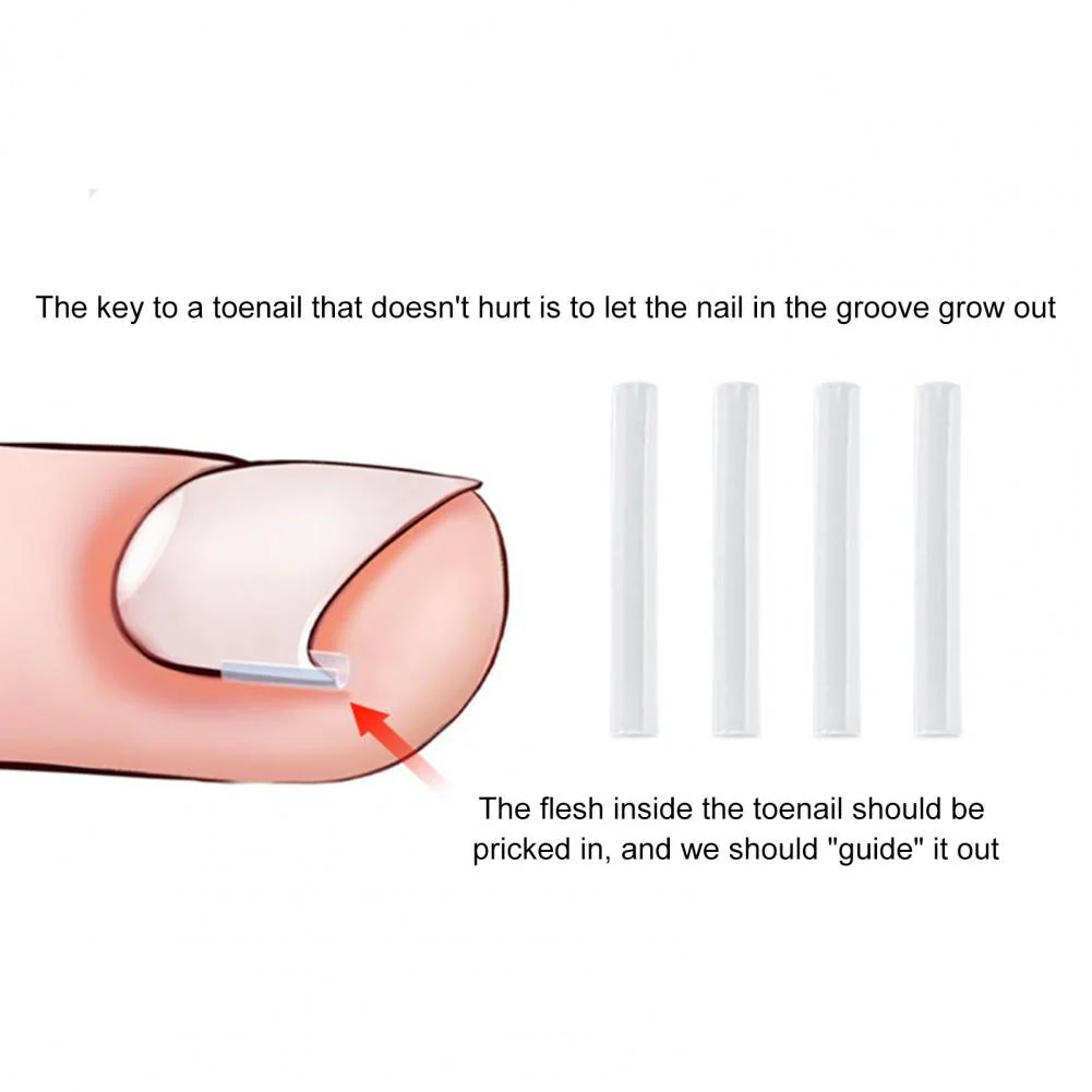 Toe Nail Support Pad - Image 5